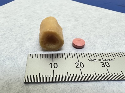 猫の甲状腺機能亢進症のちゅ~るポケットとチロブロック錠