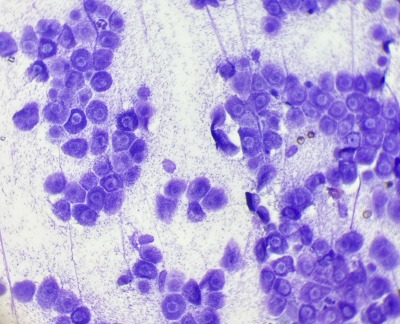 猫の皮膚肥満細胞腫 細胞診